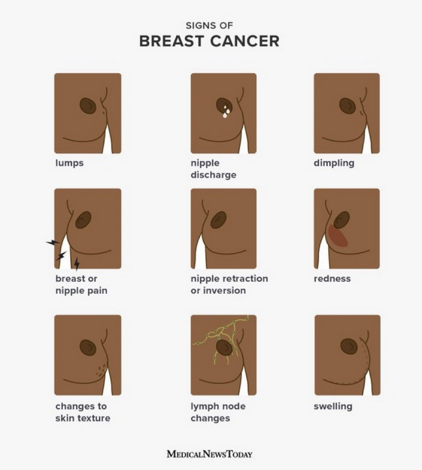 infographic depicting the various signs of breast cancer